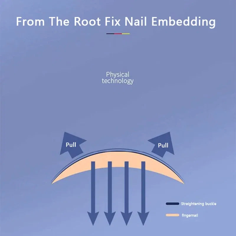 Ingrown Toenail Corrector Tools Pedicure Recover Embed Toe Nail Treatment Professional Ingrown Toenail Correction Foot CareTool