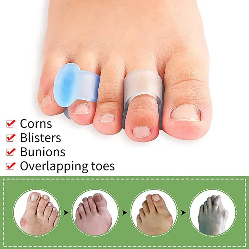 Color: Pink, Ships From: CHINA - 4pcs Silicone Finger Toe Separator Hammer Toe Correction Pad Hallux Valgus Orthopedic Bunion Guard Toe Spacer Foot Care Tool