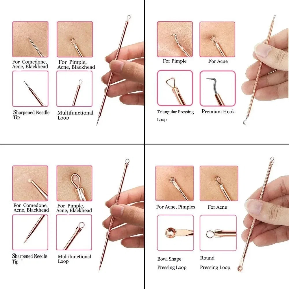 Color: Silver - 4PCS Stainless Steel Acne Needle Electroplating Colorful Rose Gold Acne Needle Extrusion Blackhead Tool Can Be Customized LOGO