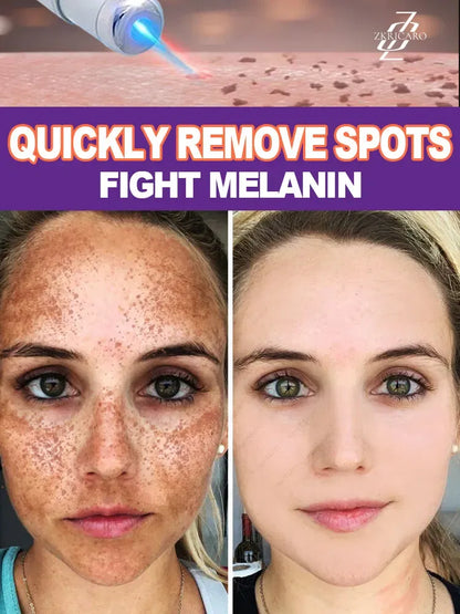 Color: WHITE - H? s? ???? ? s? ?? ??? s???, ?&ldquo