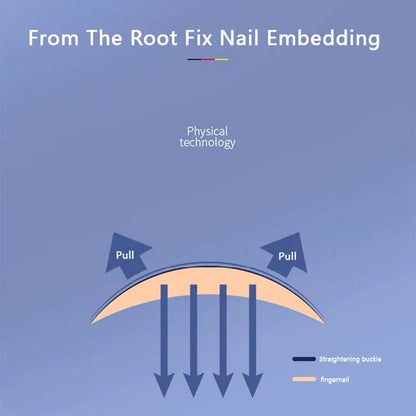 Ingrown Toenail Corrector Tools Pedicure Recover Embed Toe Nail Treatment Professional Ingrown Toenail Correction Foot CareTool